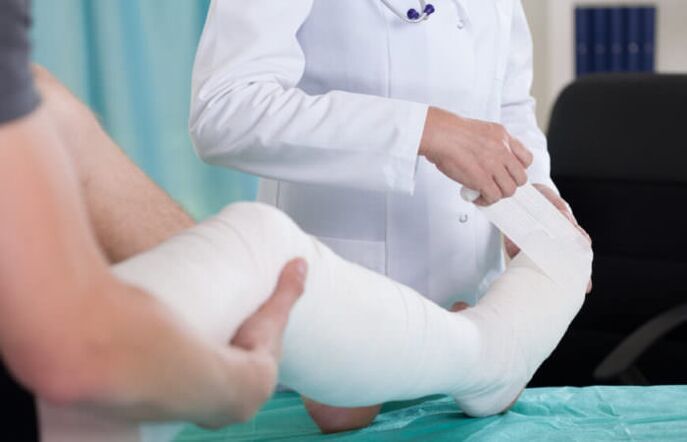 накладення гіпсу при болю в колінному суглобі